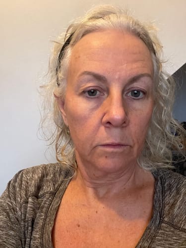 <h2>Ontdek waarom vrouwen dol zijn op de Micro-Infusie Kit™</h2>