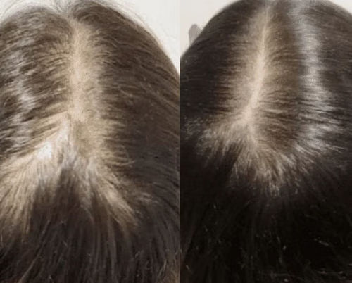 <h2>Ontdek waarom vrouwen dol zijn op HairGlow™ </h2>