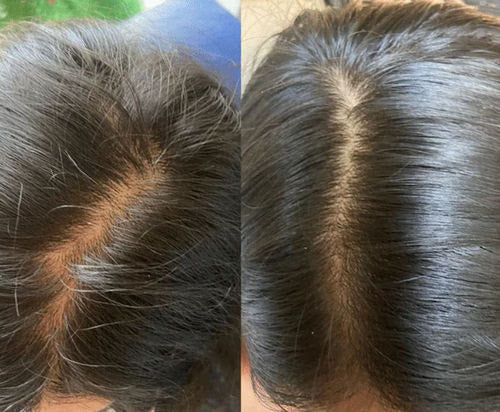 <h2>Ontdek waarom vrouwen dol zijn op HairGlow™ </h2>