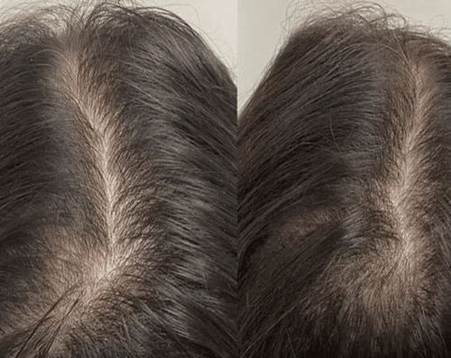 <h2>Ontdek waarom vrouwen dol zijn op HairGlow™ </h2>