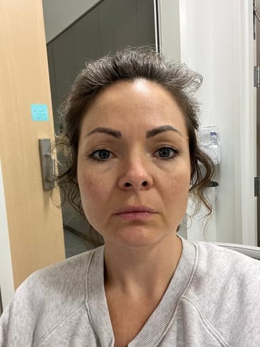 <h2>Ontdek waarom vrouwen dol zijn op de Micro-Infusie Kit™</h2>