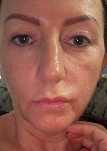 <h2>Ontdek waarom vrouwen dol zijn op de Micro-Infusie Kit™</h2>